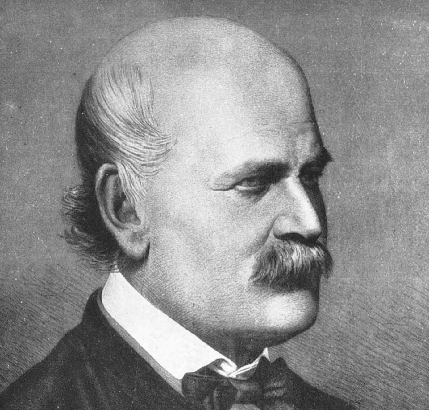 Lékař a porodník Ignác Filip Semmelweis (maďarsky Semmelweis Ignác Fülöp) (1818 – 1865). Zastánce mytí rukou u lékařů.