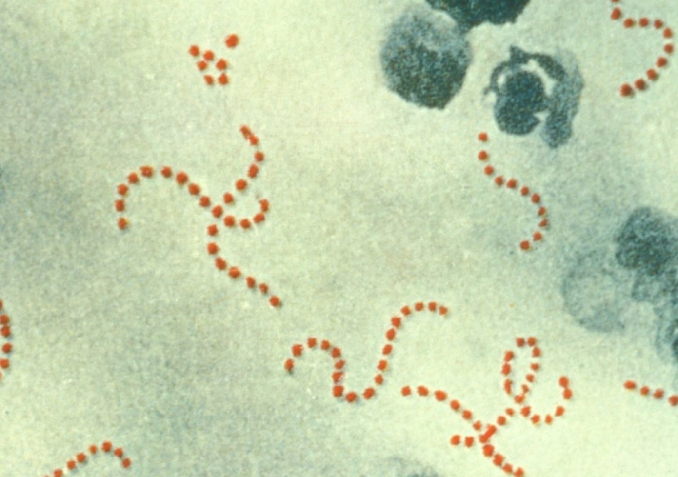 Streptococcus pyogenes patří mezi původce horečky omladnic.